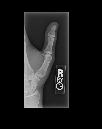 Wrist X-ray